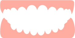 受け口（下顎前突）のイメージ
