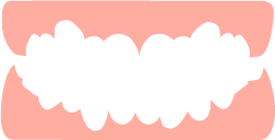 受け口（下顎前突）のイメージ